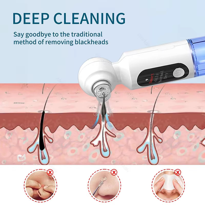 2025 New Blackhead Remover Pore Vacuum with Hot Compress Electric Facial Hydrating Cleaner Pimple Extractor Face Beauty Device