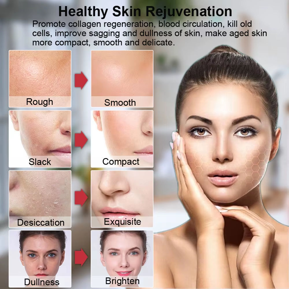 Hifu Face Lifting Machine Anti-Aging Facial Massager EMS Facial Microcurrent Face Massager Skin Rejuvenation Mini Hifu Machine