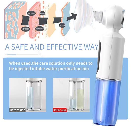 2025 New Blackhead Remover Pore Vacuum with Hot Compress Electric Facial Hydrating Cleaner Pimple Extractor Face Beauty Device